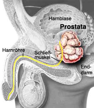 prostata-lage.jpg
