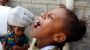 Cholera-Alarm: Impfstoffproduktion muss laut Expertengremium hochgefahren werden - DER SPIEGEL