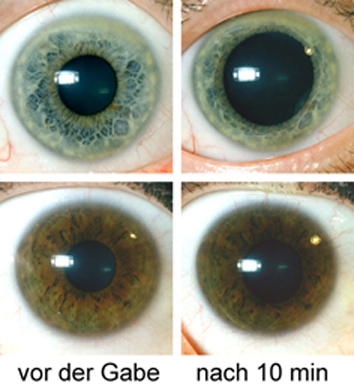 augen_mydriatikum_1_small.jpg