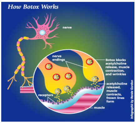 how_botox_works.png